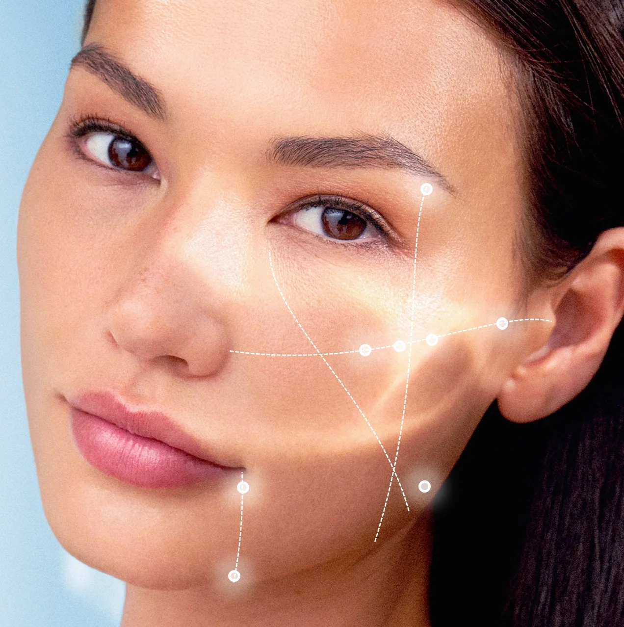 Baby Glow protocol – 8 injection points on each side of the face (Teoxane)