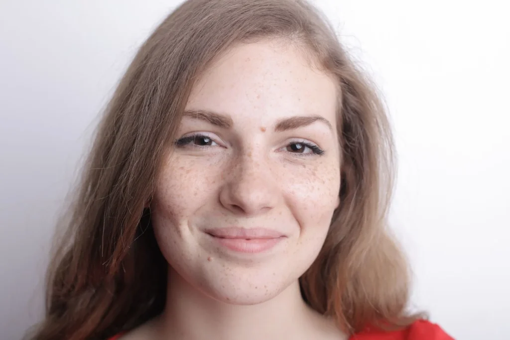 Portret van een jonge vrouw met sproeten - esthetische behandelingen in de 30